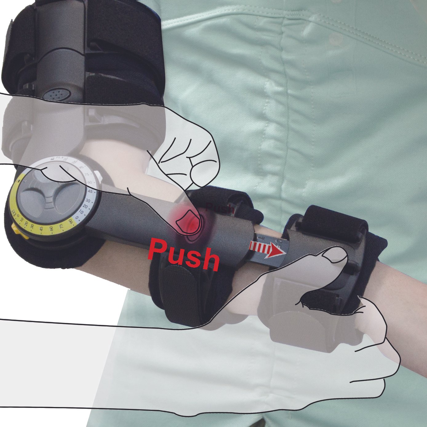 53280 LENGTH ADJUSTABLE ROM ELBOW BRACE ( RIGHT ) - Image 3